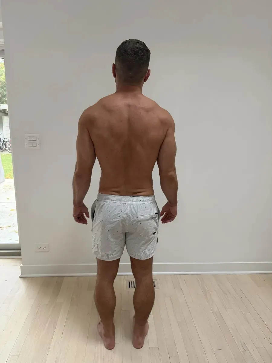 Later phase back view