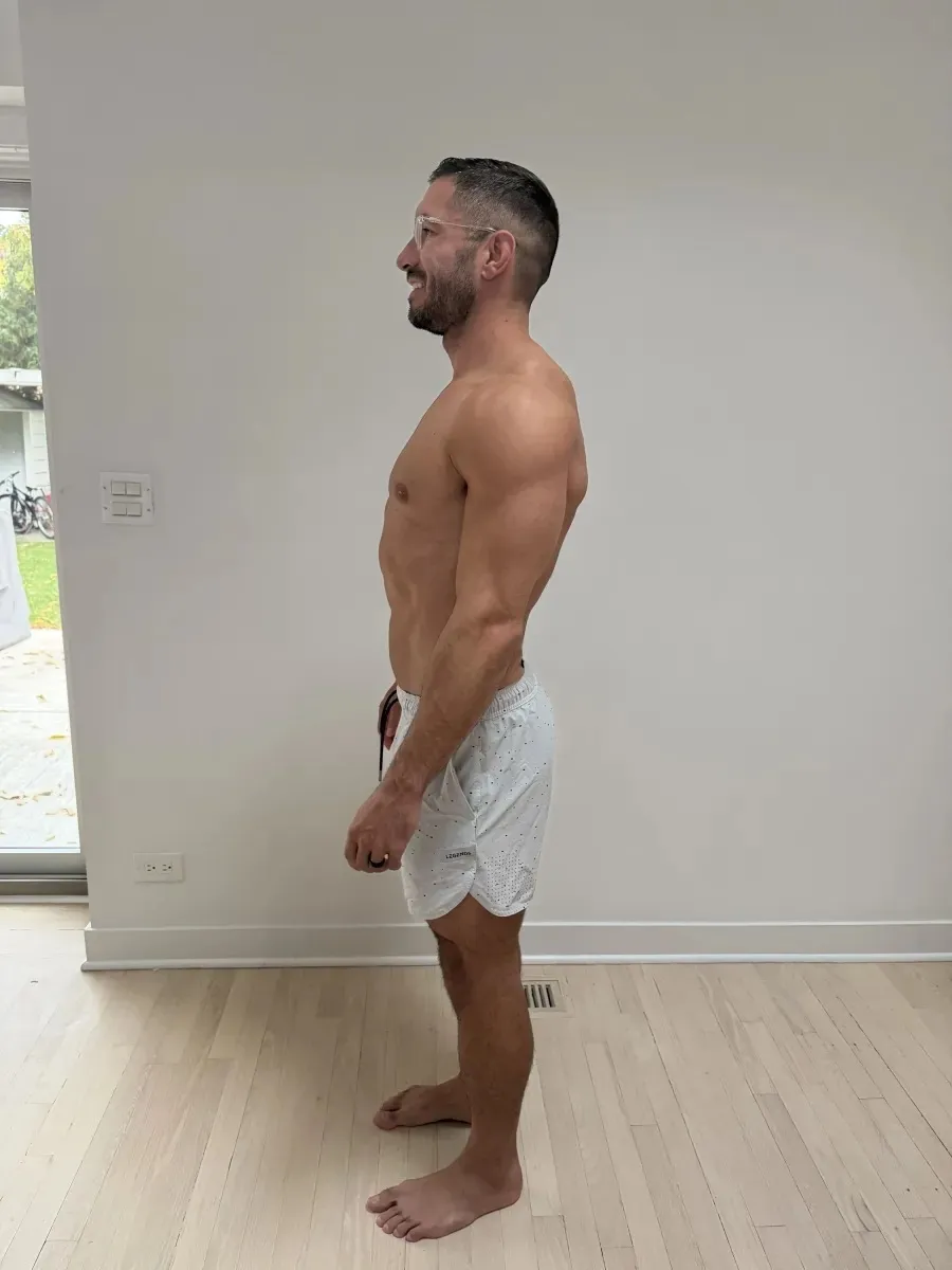 Later phase side view