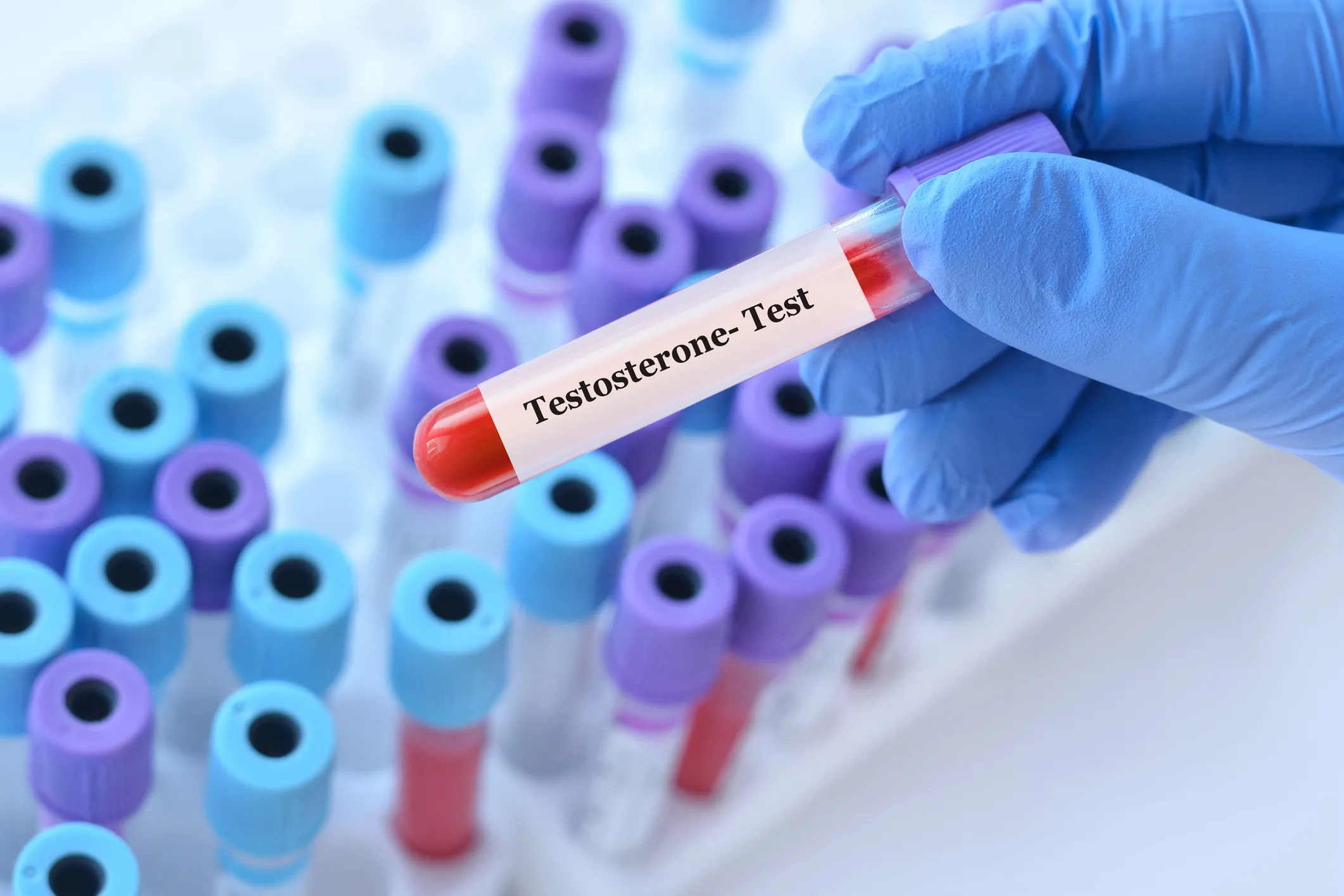 Comprehensive blood panel report — biomarker breakdown