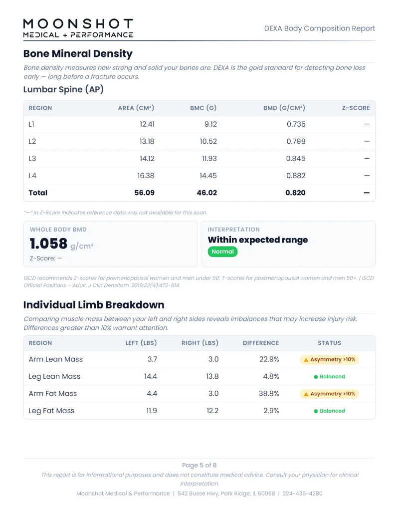 DEXA report bone mineral density T-scores