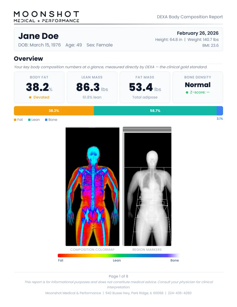 DEXA body composition report overview with colormap imaging