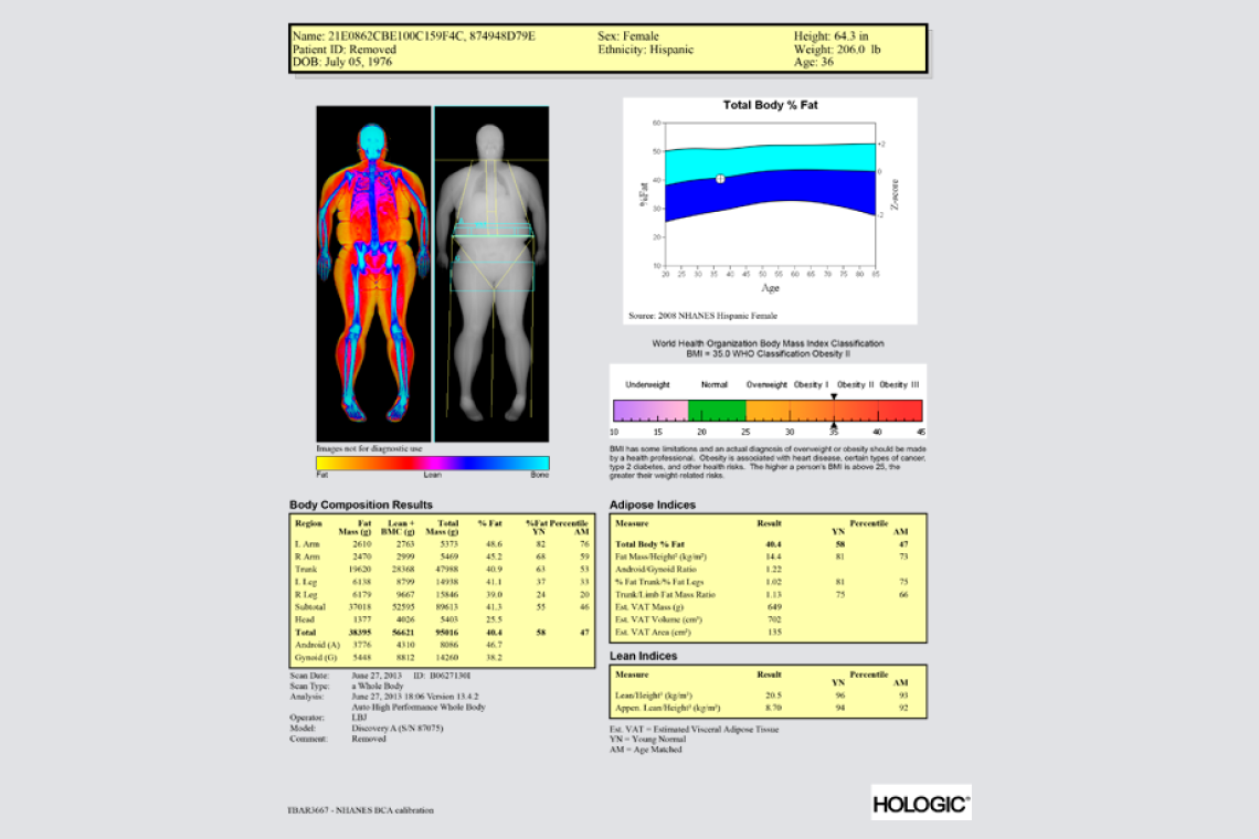 DEXA scan body composition report