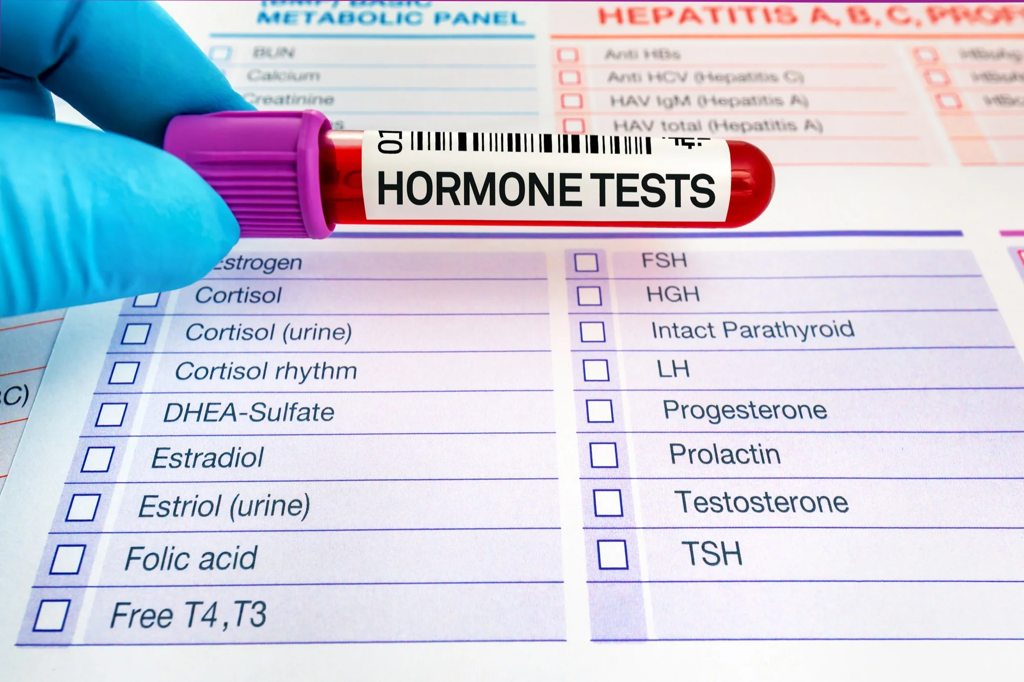 Hormone testing blood work