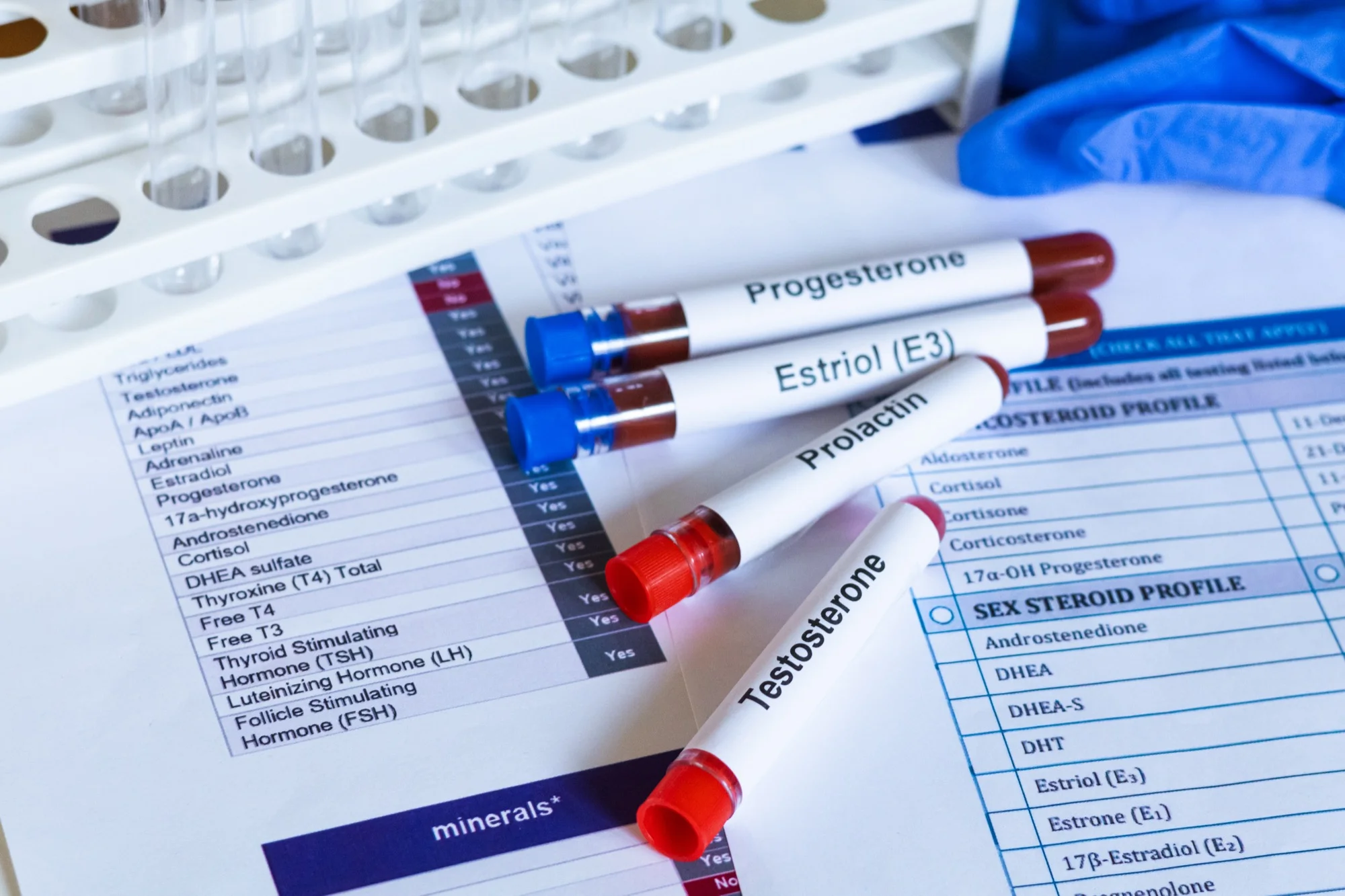 Hormone blood test tubes